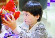 5歲女童店門口玩耍時(shí)遭惡犬狂咬 臉部血肉模糊