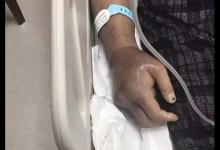 廈大回應附屬醫院院長博士論文抄襲：學術不端，不構成剽竊