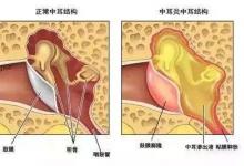 寧波22歲小伙的聽力相當(dāng)于90歲老人！竟然是因這個(gè)習(xí)慣…看完想扔手機(jī)