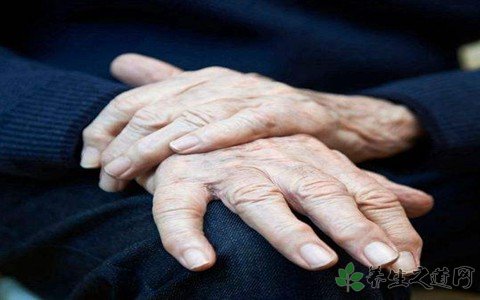 “痛風神藥”菲布力在中國上市 痛風的癥狀有哪些
