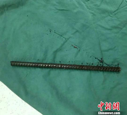 一米余長鋼筋穿破工人腹部 醫(yī)生消防協(xié)力挽回生命 一米余長鋼筋穿破工人腹部 醫(yī)生消防協(xié)力挽回生命