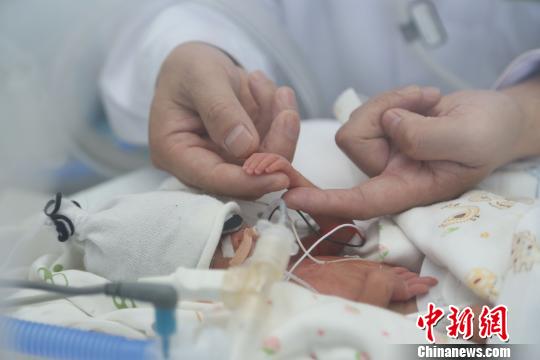 一名胎齡僅26周嬰兒從湖北恩施空中轉(zhuǎn)運(yùn)武漢 一名胎齡僅26周嬰兒從湖北恩施空中轉(zhuǎn)運(yùn)武漢