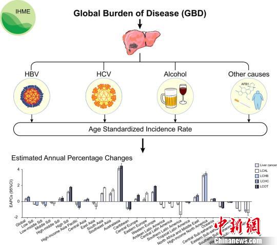 中國學者率先系統解析全球不同地區肝癌發病模式 中國學者率先系統解析全球不同地區肝癌發病模式