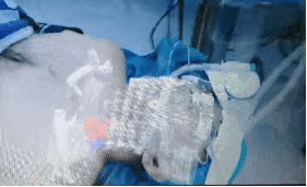 常州醫生利用MR技術做手術 宛如科幻大片 常州醫生利用MR技術做手術 宛如科幻大片