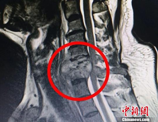 常州醫生利用MR技術做手術 宛如科幻大片 常州醫生利用MR技術做手術 宛如科幻大片