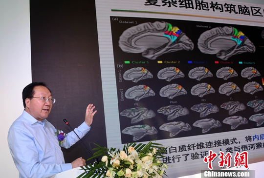 中科院自動(dòng)化所腦科研成果“落地” 研發(fā)出先進(jìn)腦氧檢測(cè)設(shè)備-易網(wǎng)健康養(yǎng)生網(wǎng) 中科院自動(dòng)化所腦科研成果“落地” 研發(fā)出先進(jìn)腦氧檢測(cè)設(shè)備