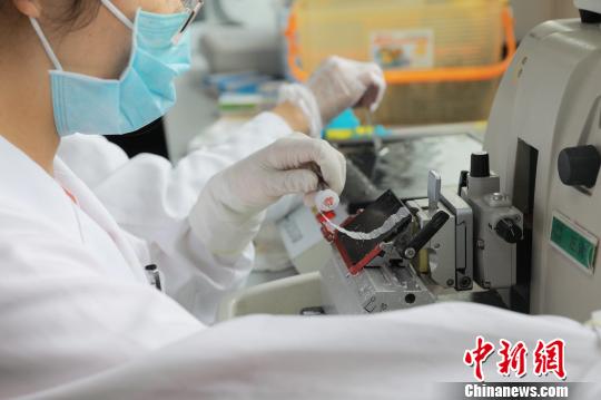 粵醫院病理檢測技術獲國際認可 與近80個國家互認病理報告-易網健康<a href=http://www.aoa7937.com/jkys/ target=_blank class=infotextkey>養生</a>網 粵醫院病理檢測技術獲國際認可 與近80個國家互認病理報告