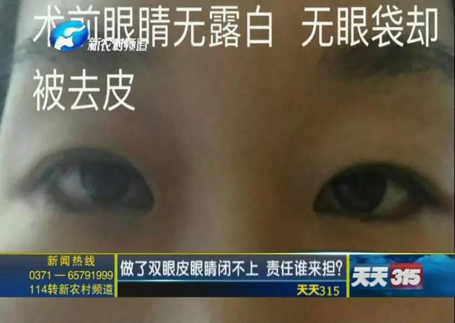女子整形失敗 許昌華姿醫(yī)美整形醫(yī)院不認(rèn)：因?yàn)獒t(yī)生已離職