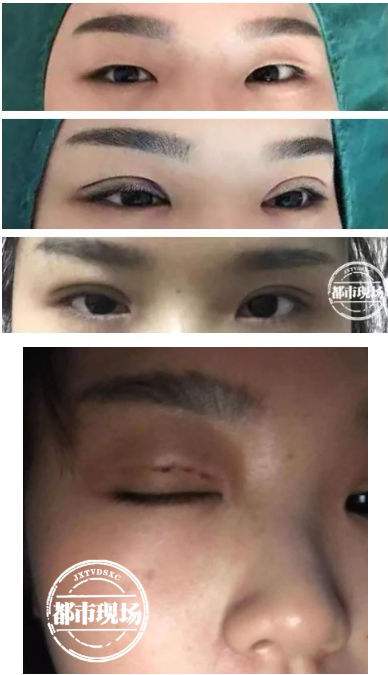 南昌愛玩美皮膚身材管理中心涉嫌無證行醫(yī) 女子花5800元整形失敗-易網(wǎng)健康<a href=http://www.aoa7937.com/jkys/ target=_blank class=infotextkey>養(yǎng)生</a>網(wǎng) 南昌愛玩美皮膚身材管理中心涉嫌無證行醫(yī) 女子花5800元整形失敗