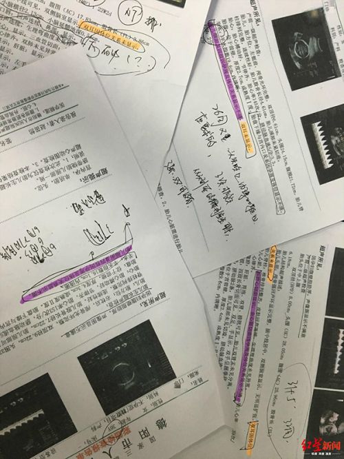 德陽市人民醫(yī)院產(chǎn)檢生下畸形兒：醫(yī)院稱符合診療規(guī)范 父親拒帶回家