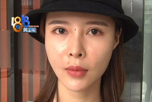 杭州麗星整形醫院整壞了鼻子至妍醫療美容來修復 醫院更名了？
