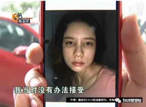 女子花4萬多在寧波首美整形美容醫院做鼻子 術后鼻子卻像被人打過