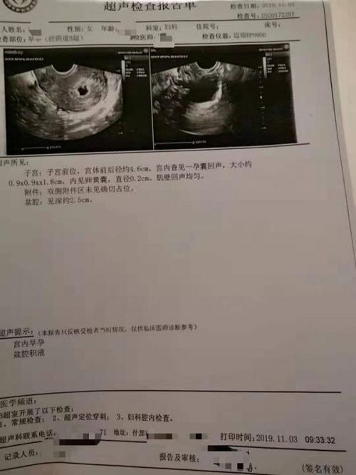 崇州蜀都醫院無相關許可證 男子結扎三個月后妻子懷孕