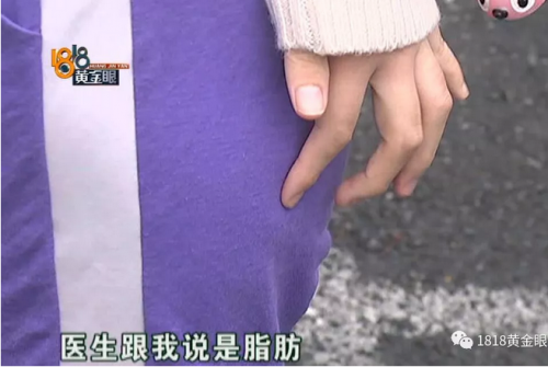 杭州麗星醫療美容醫院好不好？頻遭投訴效果差