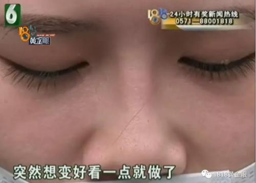 杭州世彩整形又遭消費(fèi)者投訴 采訪時(shí)院方代表有些激動(dòng)
