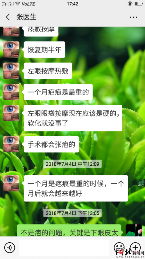 河北一女子在石家莊萬瑞醫(yī)療整形后眼睛閉不緊 醫(yī)院：不滿意可二次修復(fù)
