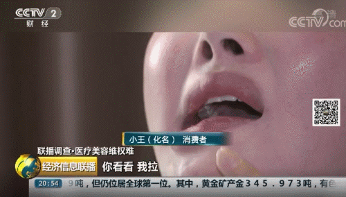 女子花3.5萬在武漢華美整形外科醫(yī)院整形致殘 院方只賠5000塊了事