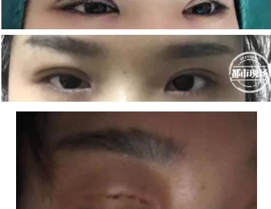 南昌愛玩美皮膚身材管理中心涉嫌無證行醫(yī) 女子花5800元整形失敗