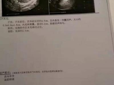 崇州蜀都醫(yī)院無相關(guān)許可證 男子結(jié)扎三個月后妻子懷孕