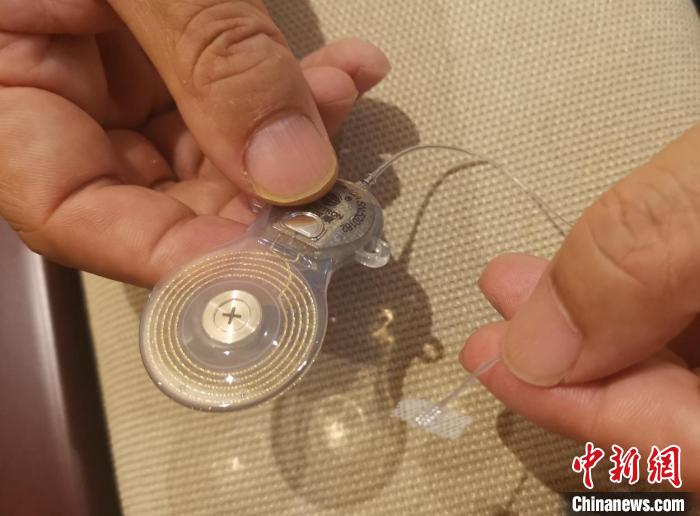 “國產人工聽覺腦干植入系統” 成果轉化簽約 擺脫進口依賴-易網<a href=http://www.aoa7937.com/ target=_blank class=infotextkey>健康養生</a>網 “國產人工聽覺腦干植入系統” 成果轉化簽約 擺脫進口依賴