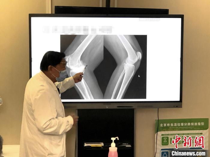 大骨節病公益項目:已為西藏244位大骨節病患者進行關節置換手術-易網健康<a href=http://www.aoa7937.com/jkys/ target=_blank class=infotextkey>養生</a>網 大骨節病公益項目:已為西藏244位大骨節病患者進行關節置換手術