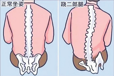 不良體態正悄悄損害你的健康(服務窗)-易網<a href=http://www.aoa7937.com/ target=_blank class=infotextkey>健康養生</a>網 不良體態正悄悄損害你的健康(服務窗)