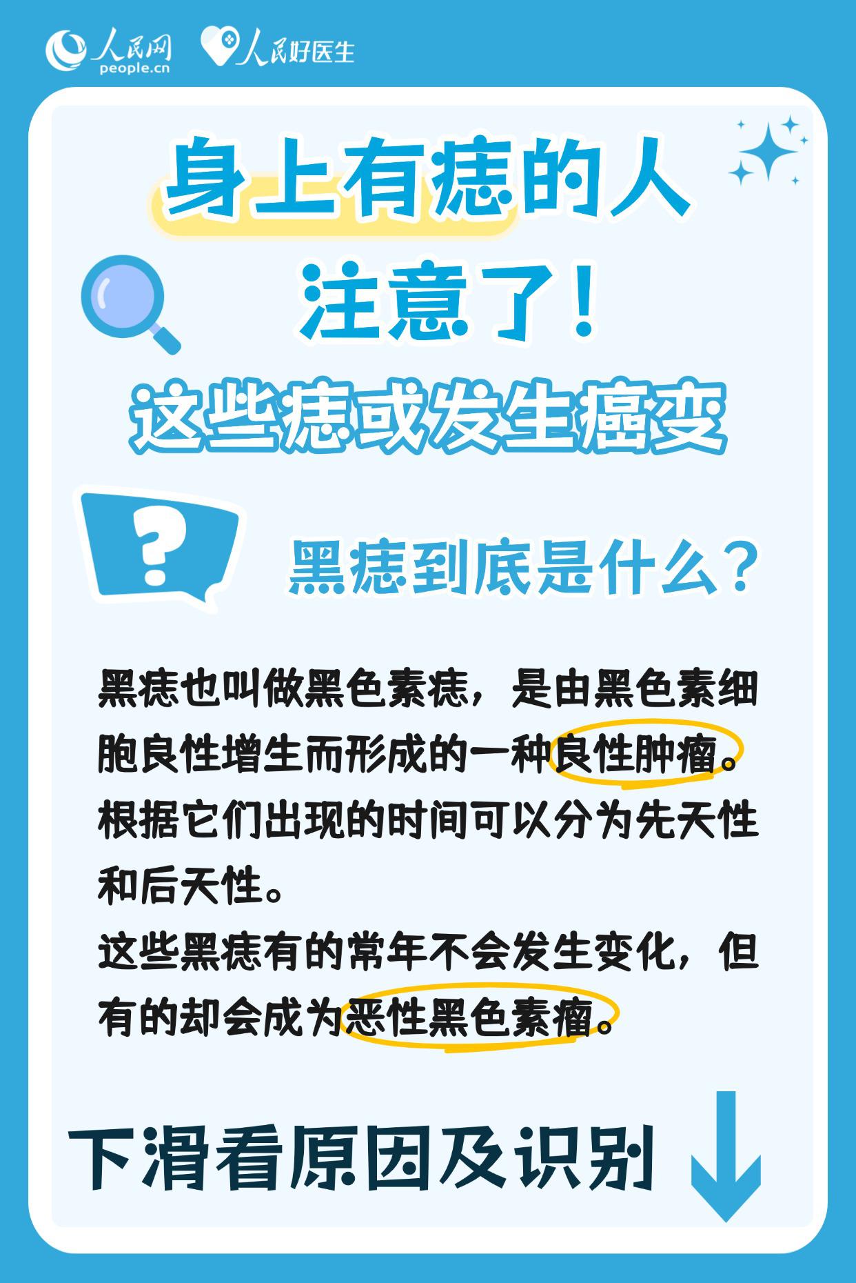 身上有痣的人注意了！這些痣可能會發生癌變