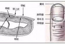 指甲發黃是肺不好？月牙少是胃有問題？指甲的6大傳言，你信了嗎？
