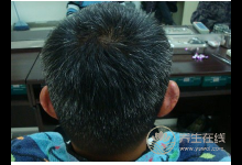 擔(dān)心白發(fā)一直冒出來？4大養(yǎng)發(fā)食物告訴你