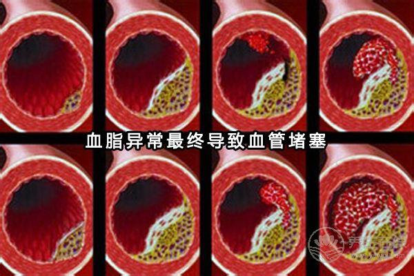 患高血脂人群越來越多，多吃這6種食物可以有效預防