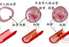 泡腳水加點(diǎn)姜，能有想不到的功效