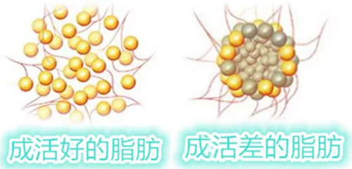 脂肪會不會轉化為糖 脂肪的消耗方法