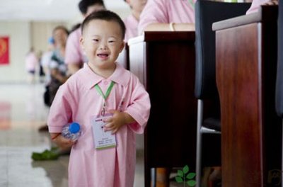 小孩患有唐氏綜合癥會(huì)有哪些明顯癥狀
