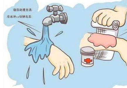 身體上有傷口是裸露好還是包扎好