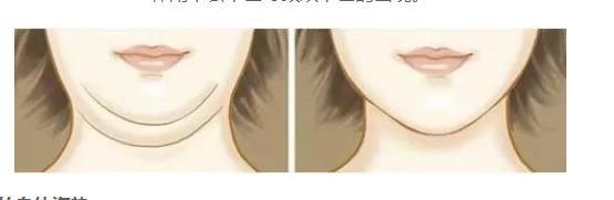 為什么會長雙下巴的幾種原因