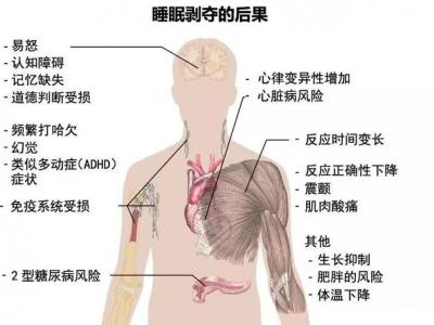 熬夜的9大壞處 了解一下