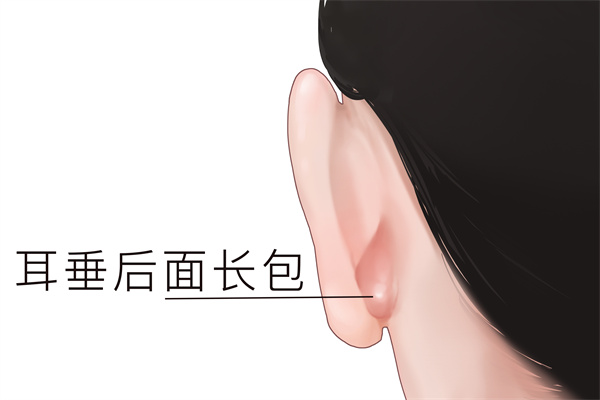耳朵后面突然鼓起一個(gè)硬包