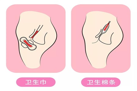 衛生棉條解放女性自由 許多人卻擔心它會弄破處女膜？