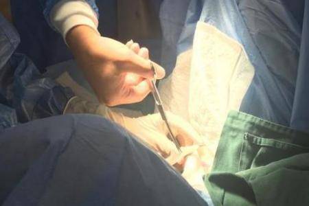 二胎剖腹產后做結扎手術 結扎對女性身體影響有多大