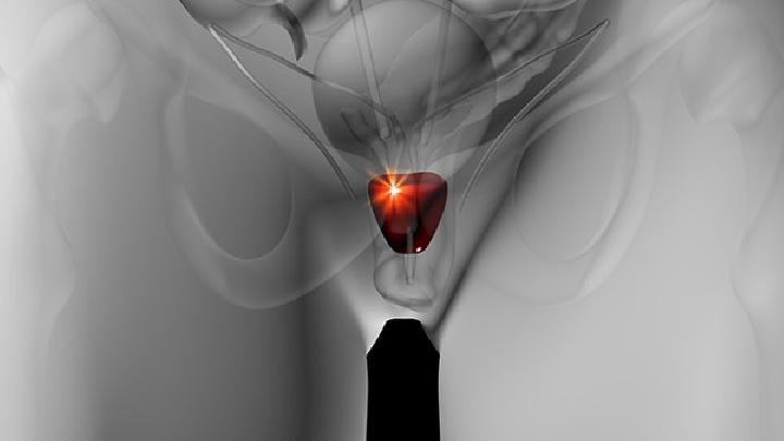 男性生殖保健的知識(shí)你了解了多少 全面介紹男性生殖保健的知識(shí)