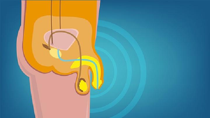 治療性功能障礙有哪些方法？男性性功能障礙的飲食調理方法
