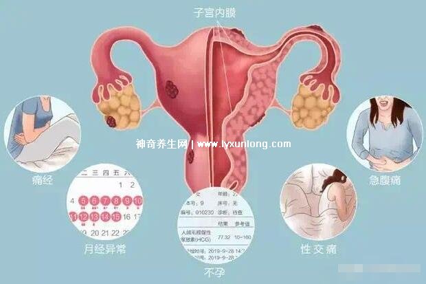 真實女生內膜破壞的圖片，剝脫的子宮內膜伴隨經血排出