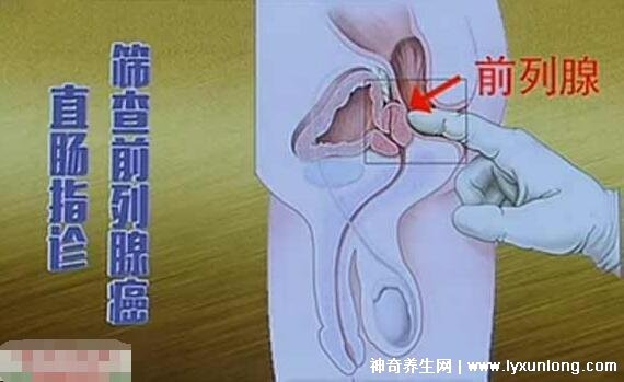 30秒自測前列腺炎，是否出現尿痛/尿頻/尿急(附自測方式)