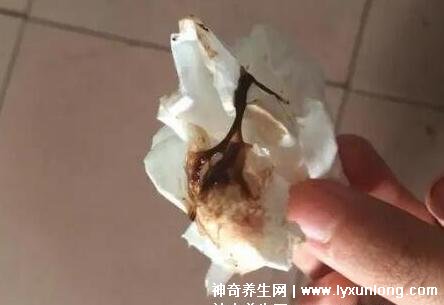 宮頸癌褐色分泌物圖片，少量不規則出血伴隨X交痛(腥臭分泌物)