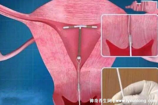 打一針不懷孕的針多少錢價(jià)格，69元避孕一個(gè)月(6款避孕針價(jià)格表)