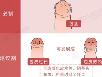 成年男子割包好處和壞處，8種情況必須割(附割包照片真實(shí))