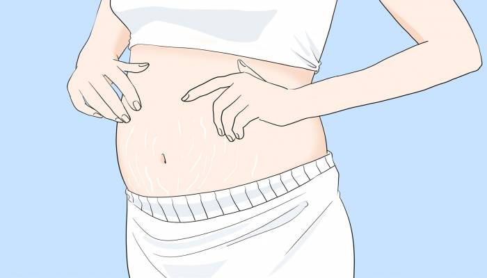 如何確認是否宮內孕或宮外孕 宮外孕的跡象有哪些