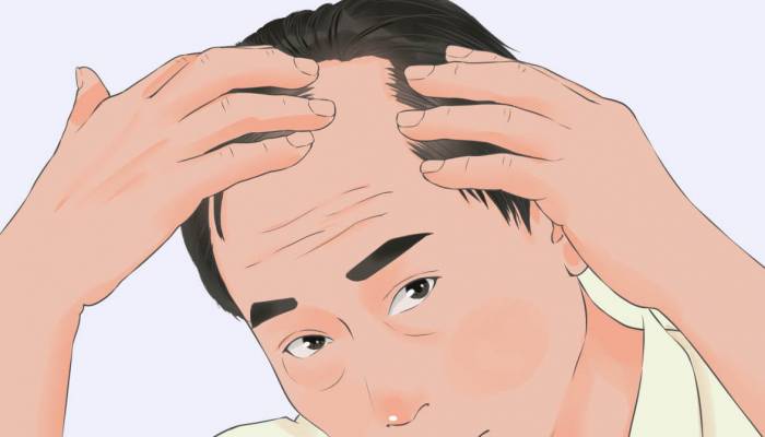性生活頻繁會加重脫發 脫發的原因有哪些