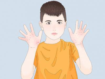 感染了艾滋病之后有什么癥狀 艾滋病有什么癥狀