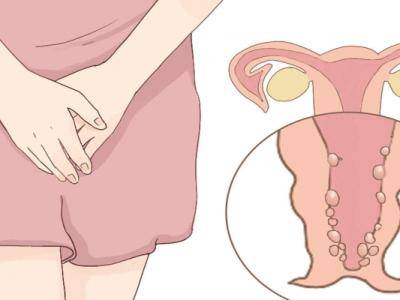 女性私處出現魚腥味，要警惕婦科疾病